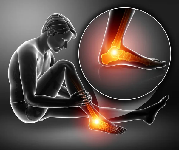 Αρσενικό πόδι με πόνο στον αστράγαλο — Φωτογραφία Αρχείου