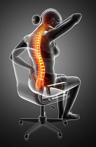 Жінки відчувають біль у спині — стокове фото