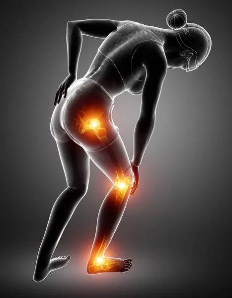 Γυναικείο πόδι πόνος στις αρθρώσεις — Φωτογραφία Αρχείου