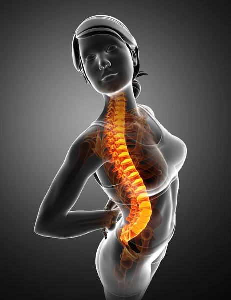 stock image Women Feeling the Back pain 