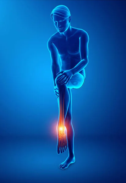 Male foot with ankle pain — Stock Photo, Image