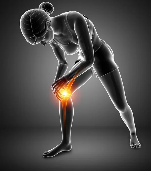 Women Knee joint pain