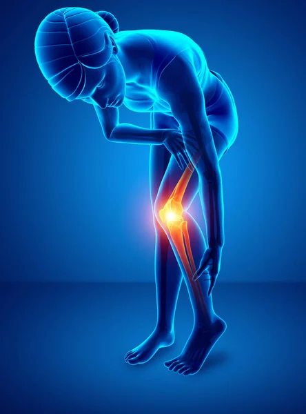 Women Knee joint pain — Stock Photo, Image