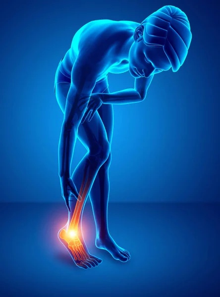 Pé masculino com dor no tornozelo — Fotografia de Stock