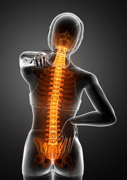 Mujeres sintiendo el dolor de espalda —  Fotos de Stock