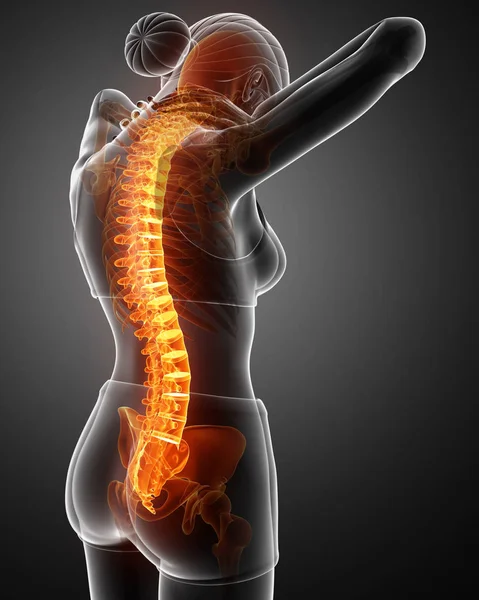 Mujeres sintiendo el dolor de espalda — Foto de Stock