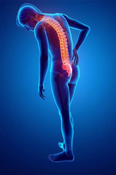 Hombre Sentir el dolor de espalda —  Fotos de Stock