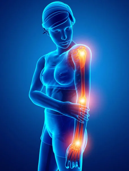 Women Feeling Arm joint pain — Stock Photo, Image