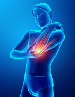 Erkekler duygu dirsek ağrısı