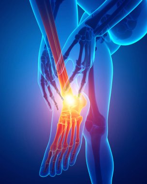 Erkek ayak ayak bileği ağrısı ile