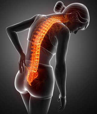 Geri ağrı hissi kadınlar 