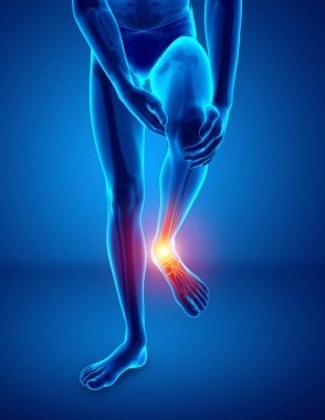 Erkek ayak ayak bileği ağrısı ile