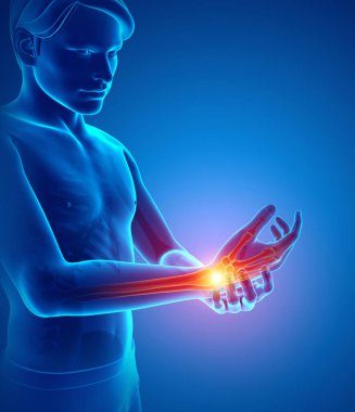 Erkekler bilek ağrı hissi