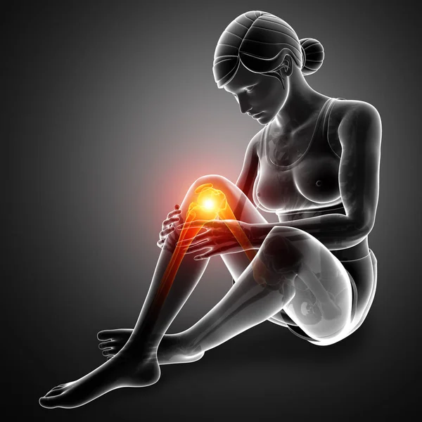 Women Knee joint pain — Stock Photo, Image