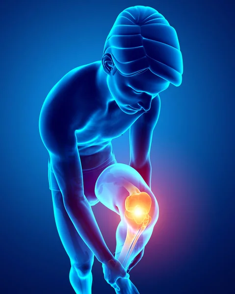 Male Knee pain — Stock Photo, Image