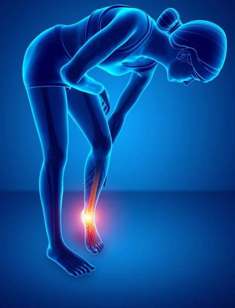 Ženské nohy bolest kotníku — Stock fotografie