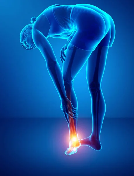 女性的脚和踝关节疼痛 — 图库照片