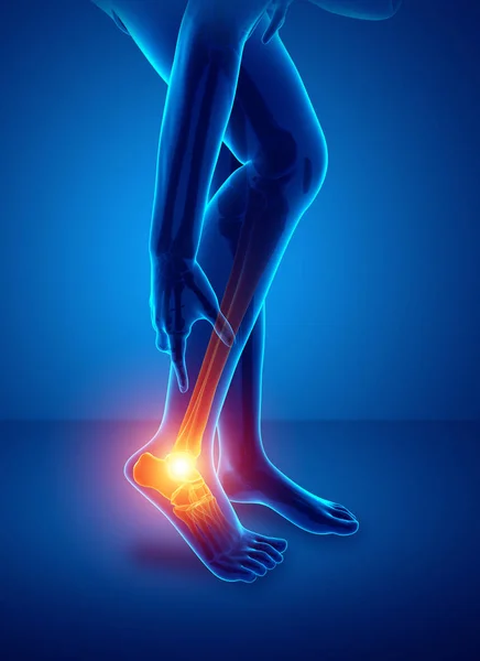 Αρσενικό πόδι με πόνο στον αστράγαλο — Φωτογραφία Αρχείου