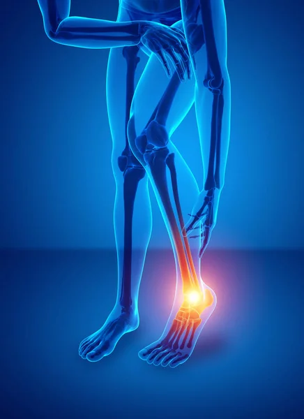 Male foot with ankle pain — Stock Photo, Image