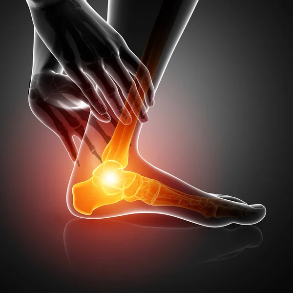 Männlicher Fuß mit Knöchelschmerzen — Stockfoto