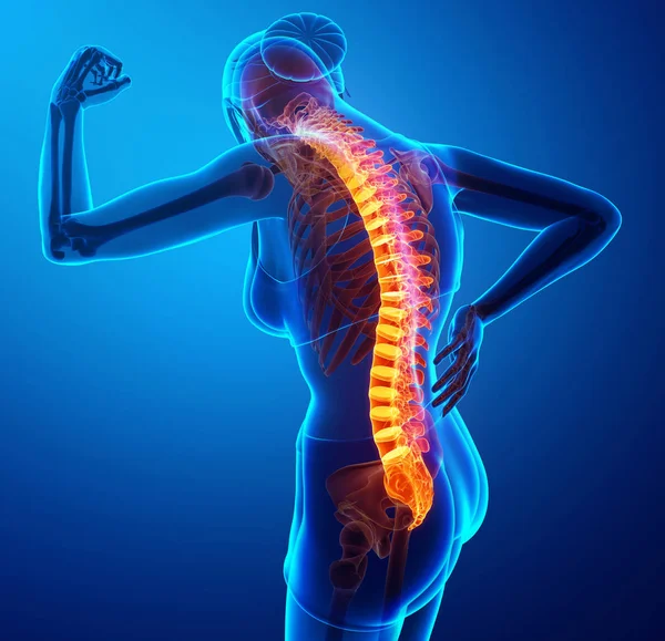Women Feeling the Back pain — Stock Photo, Image
