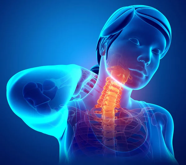 Women Feeling the Neck Pain — Stock Photo, Image