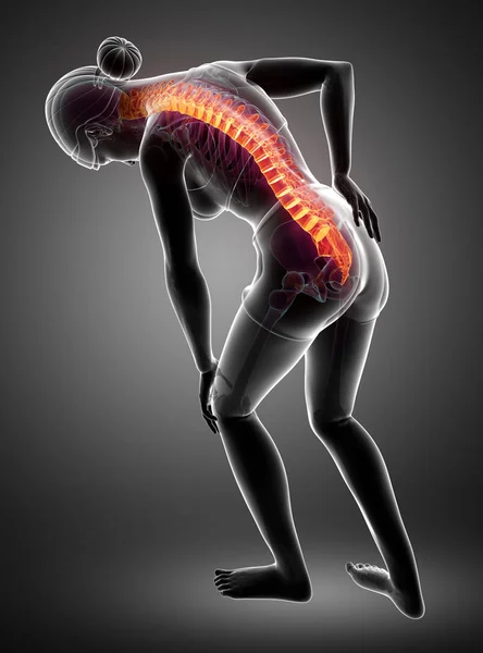 女性感觉背部疼痛 — 图库照片