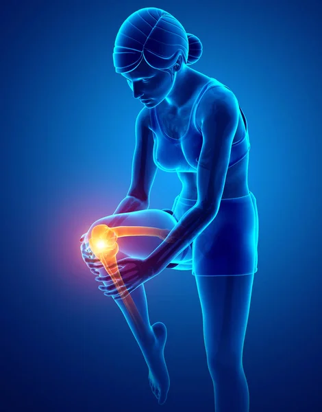 Mujer Knee dolor articular — Foto de Stock