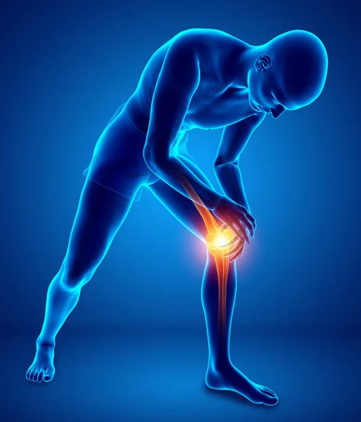 Male Knee pain — Stock Photo, Image