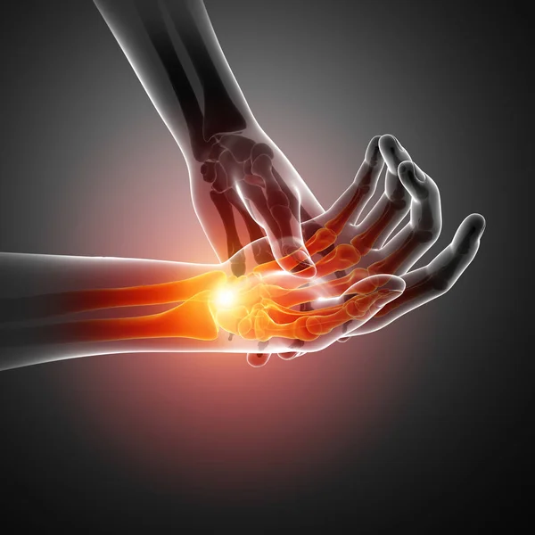 Männer spüren Schmerzen am Handgelenk — Stockfoto