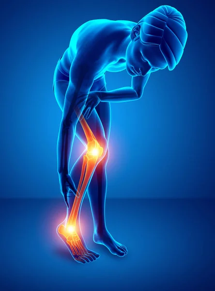 Pain in leg — Stock Photo, Image
