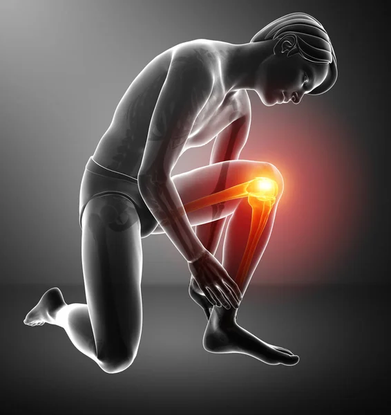 Mannelijke kniepijn — Stockfoto