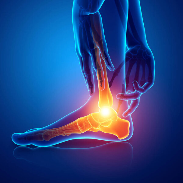 Мужская нога с болью в лодыжке
