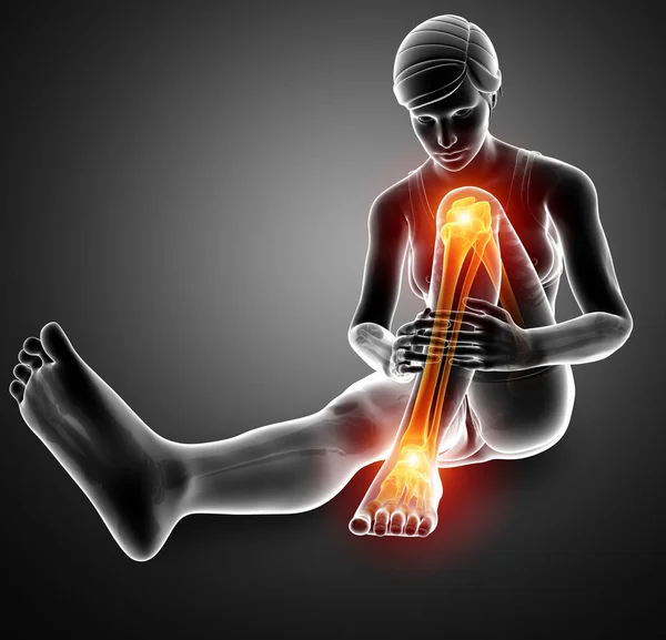Bacak ağrısı — Stok fotoğraf