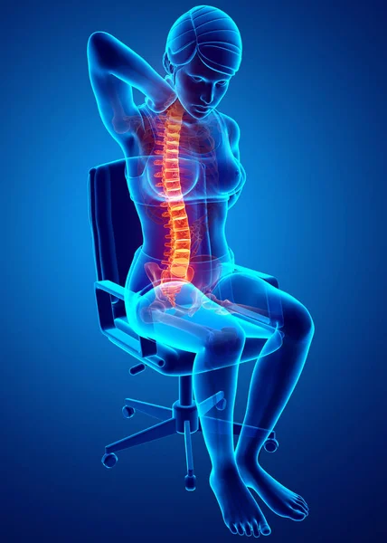 Mujeres sintiendo el dolor de espalda — Foto de Stock