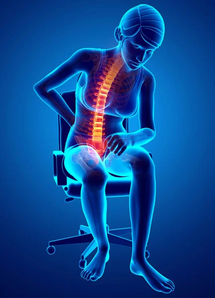 Mulheres sentindo dor nas costas — Fotografia de Stock