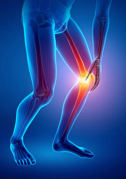 男性の膝の痛み — ストック写真