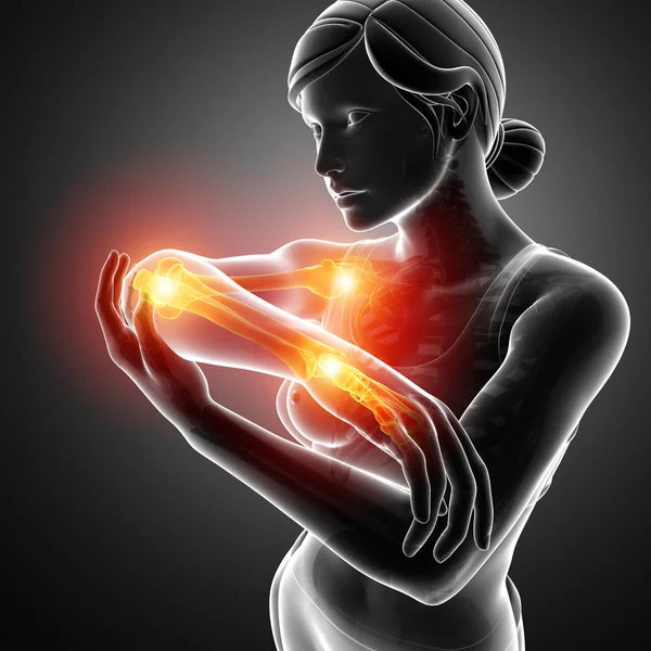 Женщины чувствуют боль в суставах рук — стоковое фото