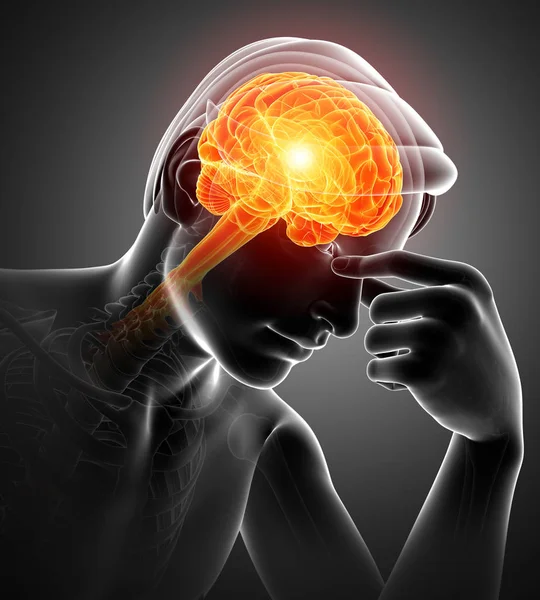 Männer spüren Kopfschmerzen — Stockfoto