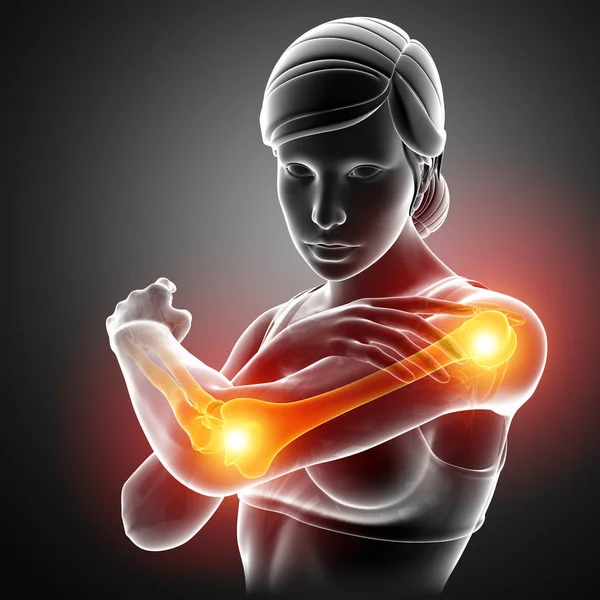 Kadınlar duygu kol eklem ağrısı — Stok fotoğraf