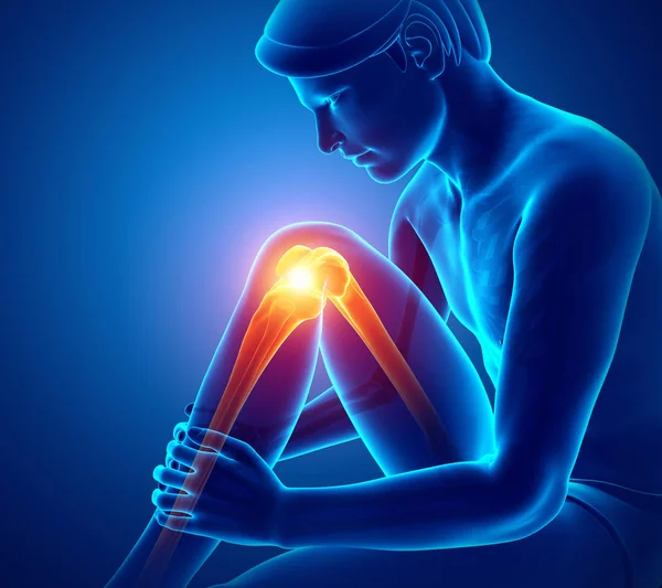 남성 무릎 통증 — 스톡 사진