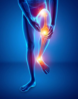 Erkek bacak eklem ağrısı