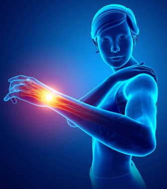 Omuz ağrısı hissediyor kadın