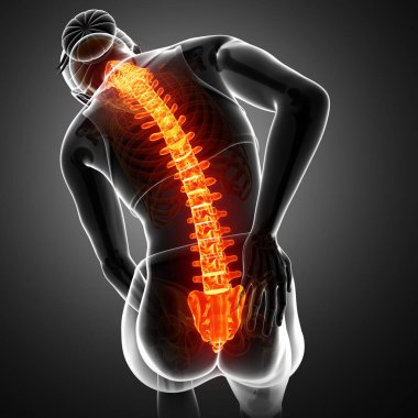 Geri ağrı hissi kadınlar 