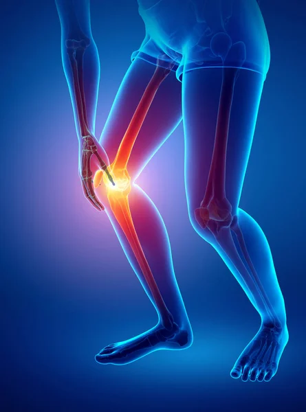 Mujer Knee dolor articular — Foto de Stock