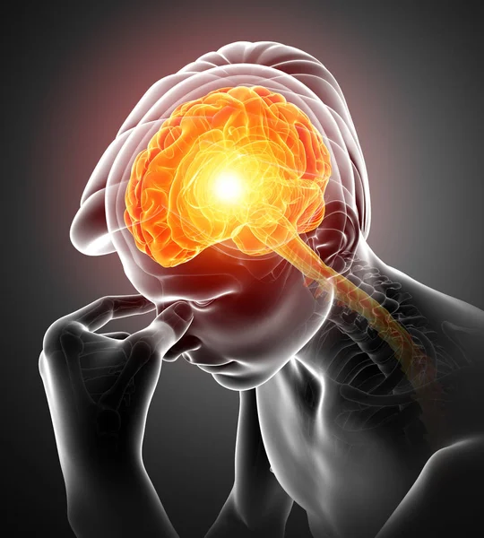 Männer spüren Kopfschmerzen — Stockfoto