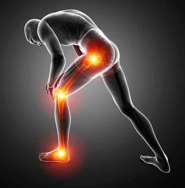 Dolor de articulación de la pierna masculina —  Fotos de Stock