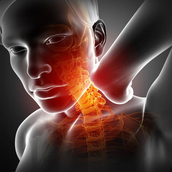 Male Feeling the Neck Pain — Stock Photo, Image