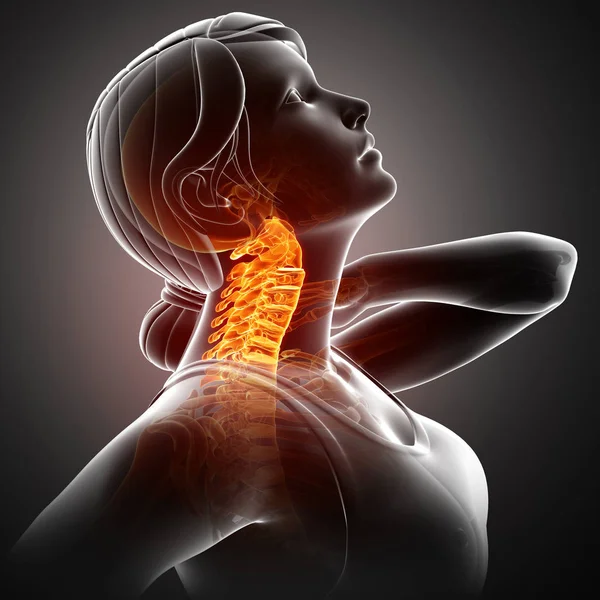 Mujeres sintiendo el dolor del cuello — Foto de Stock