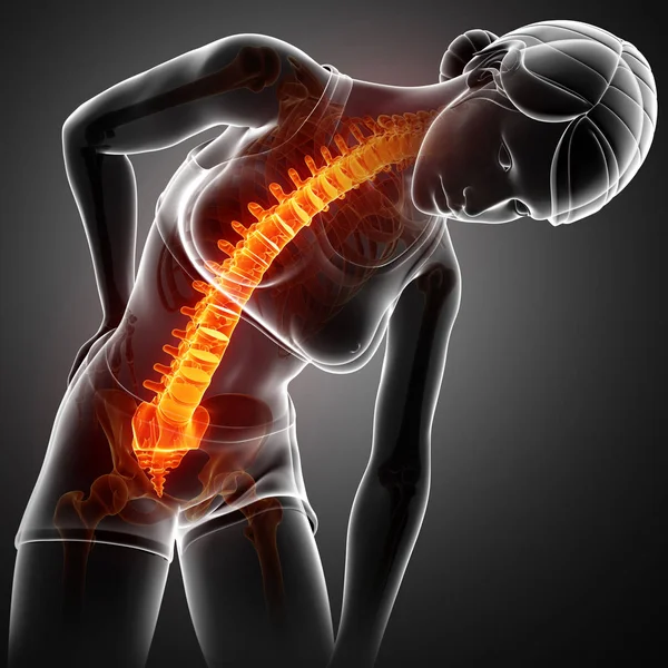 Donne che sentono il mal di schiena — Foto Stock